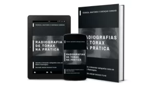 Manual Digital de Radiografias de Tórax para Profissionais de Saúde